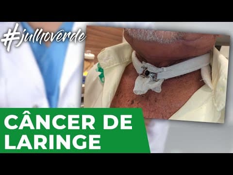 Câncer de laringe | Campanha Julho Verde