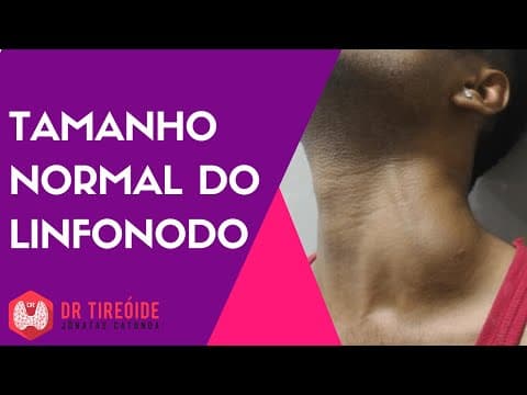 Qual é o tamanho normal do linfonodo no pescoço