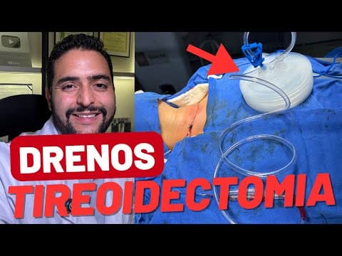 Cirurgia da tireoide: como é a recuperação e quando o dreno é necessário?