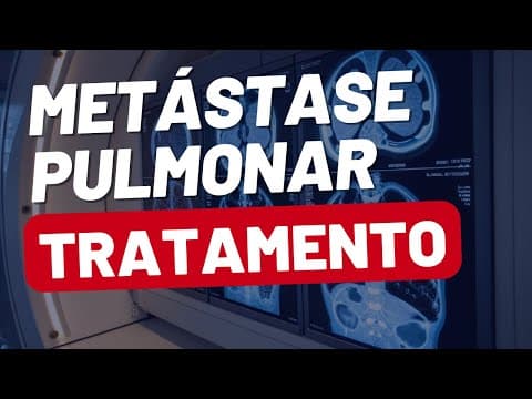 Como funciona a iodoterapia nas metástases de tireoide