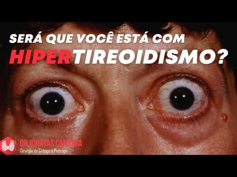 Sinais e sintomas que você está com HIPERTIREOIDISMO