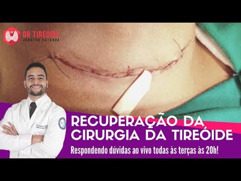 Recuperação da cirurgia da tireóide - Dr Tireóide responde