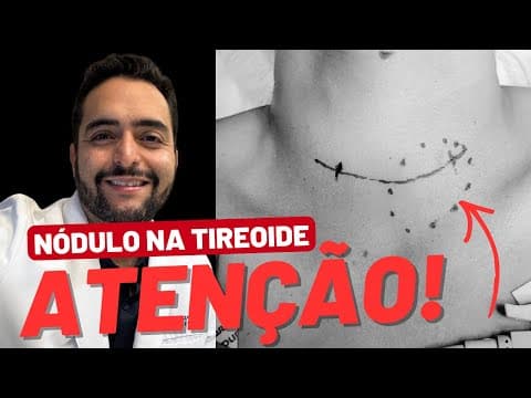 Quando um nódulo na tireoide merece mais atenção?