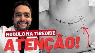 Quando um nódulo na tireoide merece mais atenção?