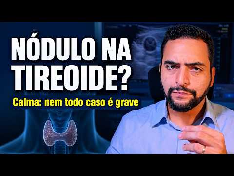 Descobri um nódulo na tireoide: é câncer? Preciso operar?