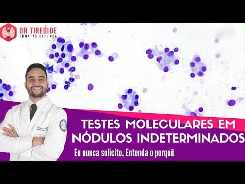 Testes moleculares em nódulos indeterminados na PAAF da tireóide - LIVE