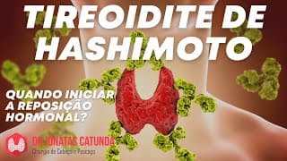 Tireoidite de Hashimoto: Quando iniciar a medicação?