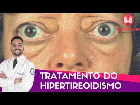 Tratamento do Hipertireoidismo