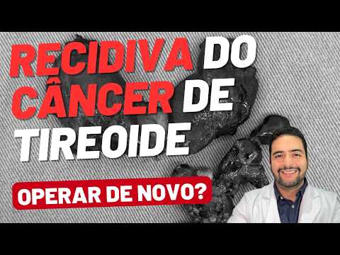 Recidiva do Câncer de Tireoide: sempre precisa operar de novo?