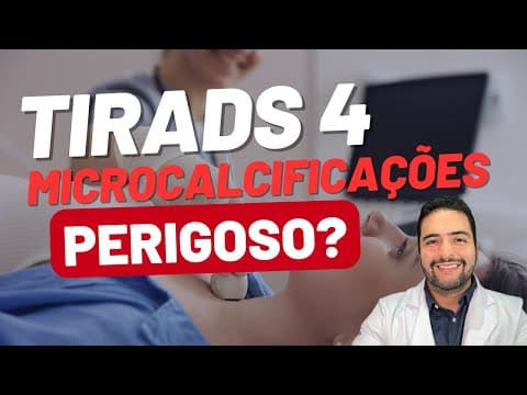 TIRADS 4 com microcalcificações: devo me preocupar?
