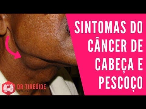 Sintomas do Câncer de Cabeça e Pescoço | Dr Jônatas Catunda