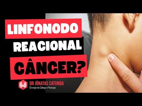 Linfonodo reacional: como saber se é câncer?
