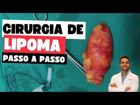 Cirurgia de lipoma no pescoço filmada passo a passo, completa