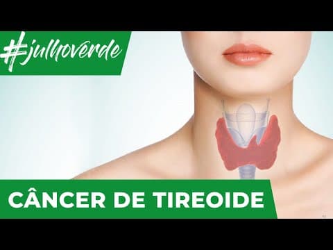 Câncer de tireóide | Campanha Julho Verde