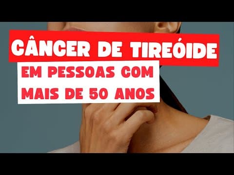 Câncer de tireoide é mais agressivo em pessoas com mais de 50 anos