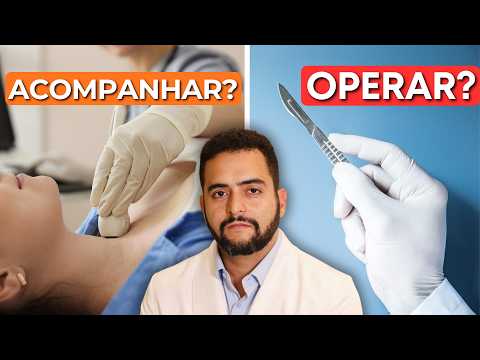 Nódulo na tireoide: quando acompanhar e quando operar | Dr. Jônatas Catunda