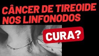 Câncer de tireoide com linfonodos: ainda tem cura?