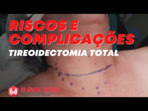 Tireoidectomia total é uma cirurgia perigosa? Riscos e complicações