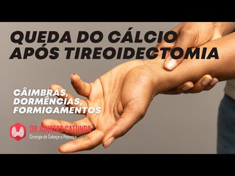Cálcio baixo após a cirurgia da tireoide - Hipoparatireoidismo