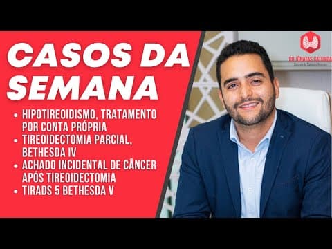 Casos da semana - hipotireoidismo x gravidez, Tireoidectomia parcial no bethesda IV, iodoterapia