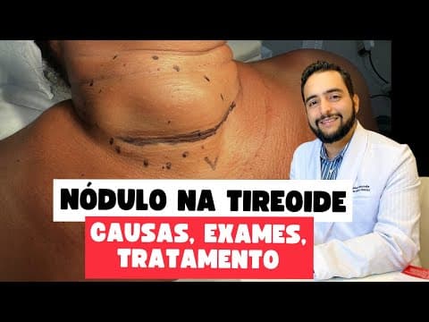 Nódulos na Tireoide: O Que Você Precisa Saber