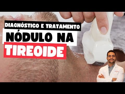 Nódulo na tireoide: como é o diagnostico e o tratamento