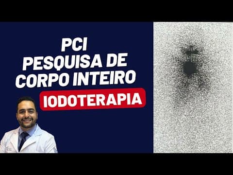PCI - PESQUISA DE CORPO INTEIRO / RADIOIODOTERAPIA NO CÂNCER DE TIREOIDE