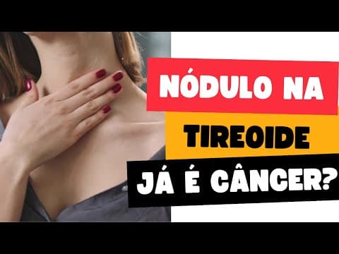 Nódulo na tireóide: Tirads 4 de 0,5cm já é cancer? | Ao vivo respondendo perguntas