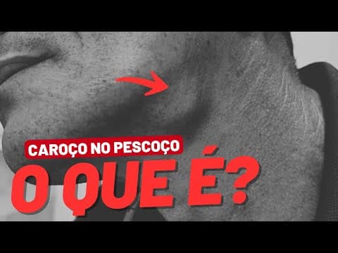 Caroço no pescoço: íngua, tireoide ou câncer?