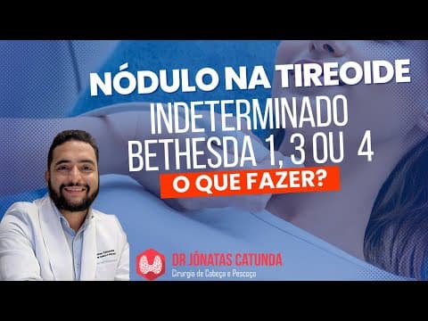 Nódulo na tireoide - punção indeterminada, Bethesda 1, 3 ou 4