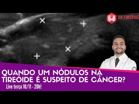 Quando um nódulo na tireóide é suspeito de câncer? Dr Tireóide responde