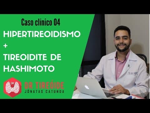 Hipertireoidismo causado por Tireoidite de Hashimoto - Caso clínico | Dr Jônatas Catunda