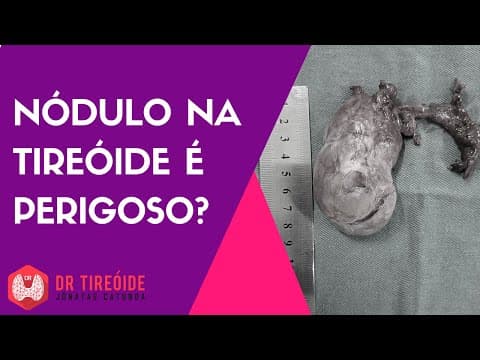 Nódulo na tireóide é perigoso? | Dr Jônatas Catunda