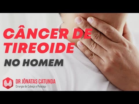 Câncer de tireoide no homem - Cada vez mais comum
