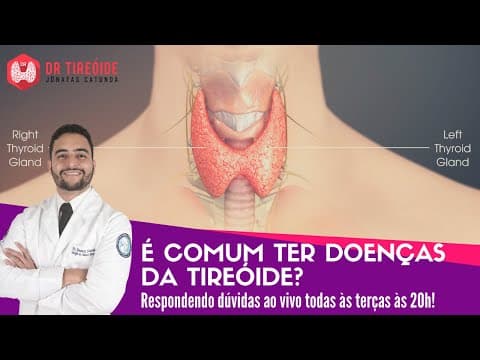 Você pode ter alguma doença da tireóide e ainda não saber! - Dr Tireóide responde