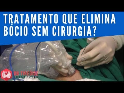 Tratamento que elimina bócio sem cirurgia? | Dr Tireóide Responde