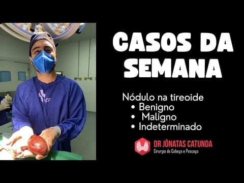 Casos da semana - nódulos na tireoide, benigno, maligno e indeterminado