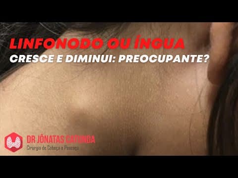 Linfonodo ou íngua no pescoço que cresce e diminui - É grave?