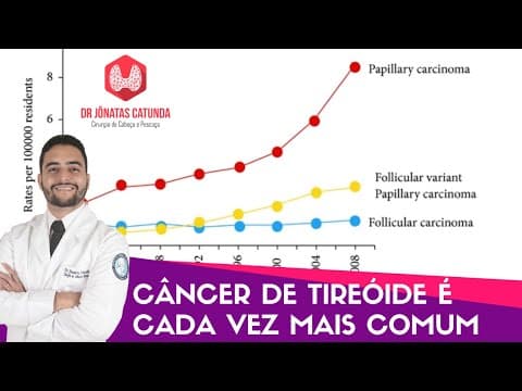 Câncer de tireóide - cada vez mais comum