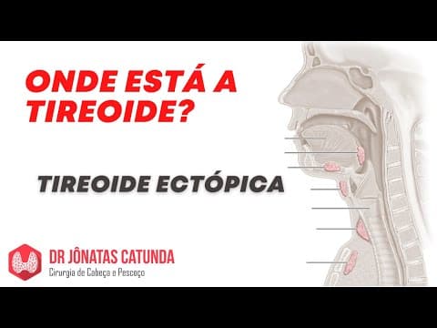 Caso atípico - Não encontrou a tireoide no pescoço