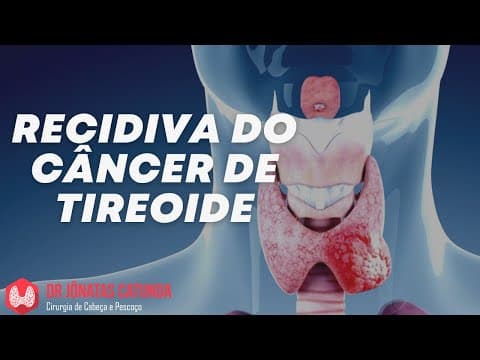 Recidiva do câncer de tireoide - próximos passos