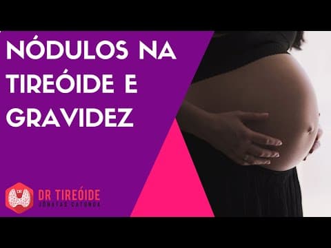 Nódulo na tireóide e gravidez | Dr Jônatas Catunda