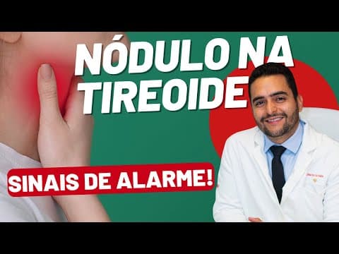 Nódulo na Tireoide: 3 sinais de alarme que você não deve ignorar!