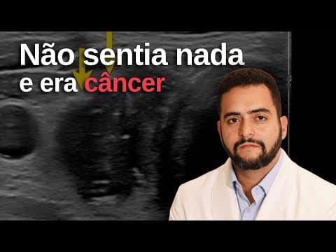 Câncer de tireoide dá sintomas? Como ele costuma ser descoberto