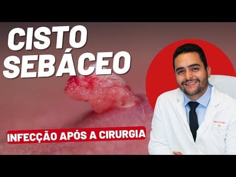Infecção após cirurgia de cisto sebáceo: sinais