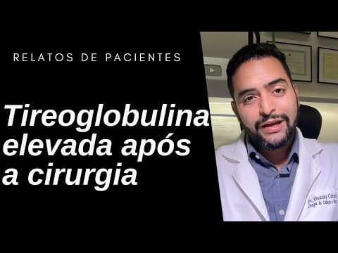 Operou o câncer de tireoide mas a tireoglobulina nunca baixou: RECIDIVA? | Dr. Jônatas Catunda