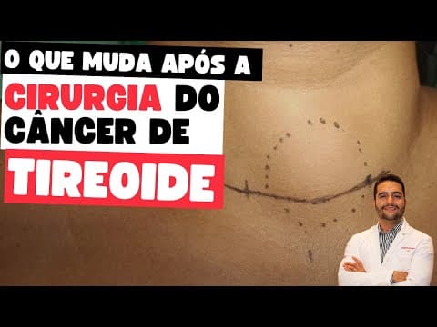 Vida após a cirurgia para o câncer de tireoide: mudanças, cuidados e expectativas