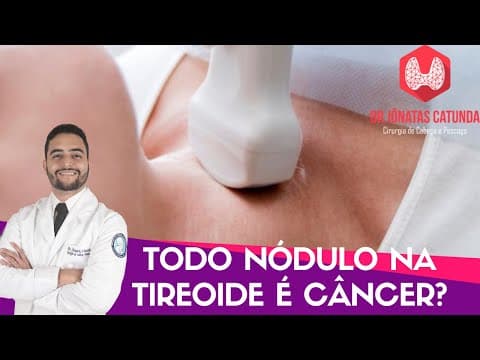 Todo nódulo na tireóide é maligno? Live respondendo perguntas