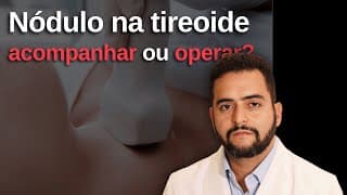 Nódulo na tireoide: quando preocupar? Tire suas dúvidas ao vivo