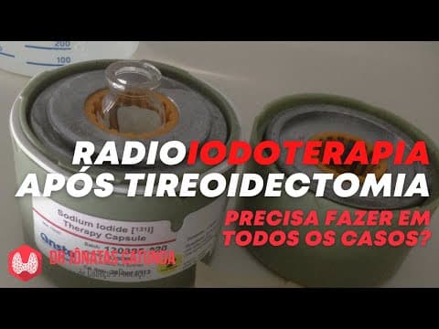 Radioiodoterapia no câncer de tireoide: todos os casos tem indicação?